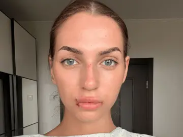 Imlive Free Live Porn of MissVi