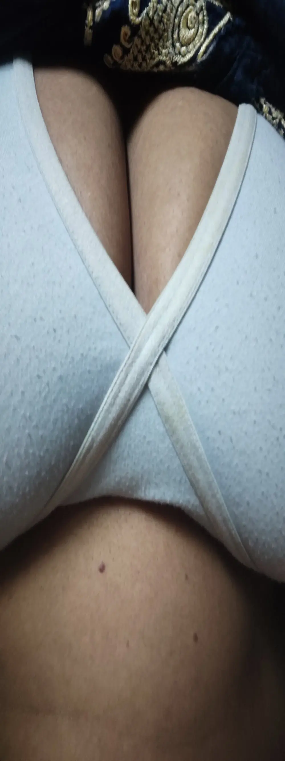 Zioo1